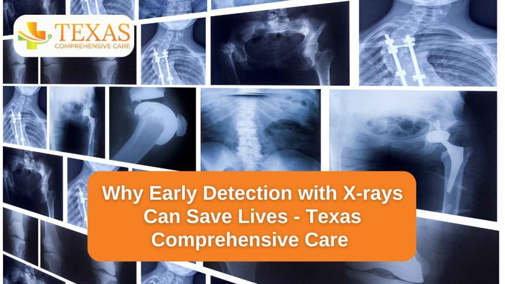 Why Early Detection with X-rays Can Save Lives - Texas Comprehensive Care