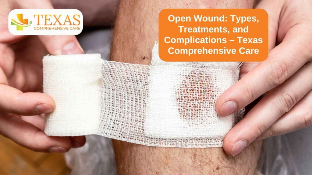 Open Wound- Types, Treatments, and Complications – Texas Comprehensive Care